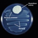 Penicillin – Wonderstuff