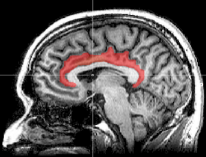 MRI cingulate cortex