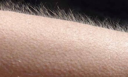 Why do we get goose bumps when we are cold?